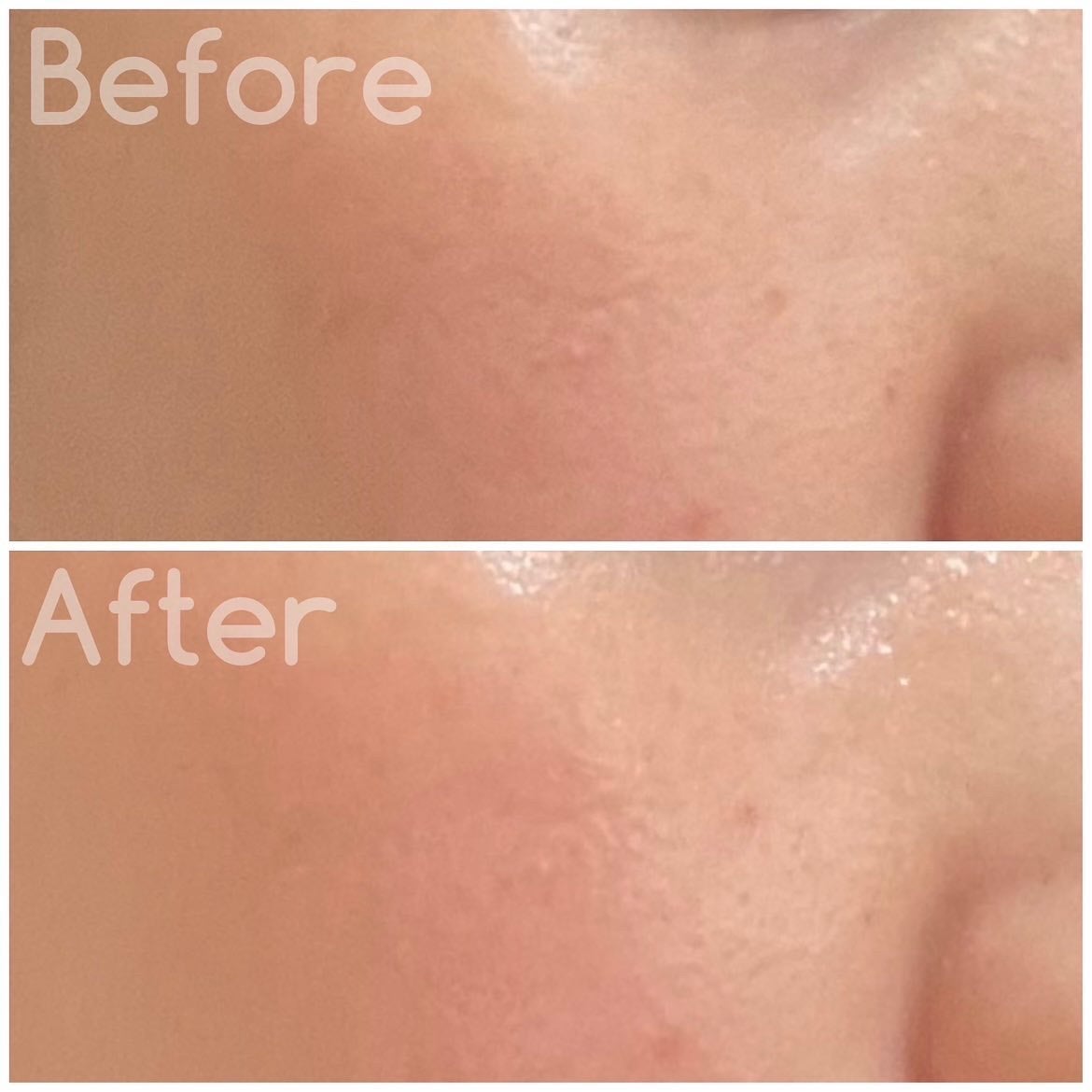 タイム イズ ランニング アウト ミスト/SIORIS/ミスト状化粧水を使ったクチコミ(4枚目)