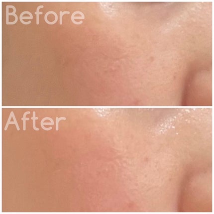 タイム イズ ランニング アウト ミスト/SIORIS/ミスト状化粧水を使ったクチコミ(4枚目)