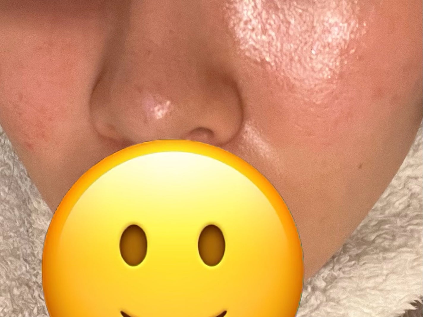 レシピオ モイストローションR/レシピオ/化粧水を使ったクチコミ(3枚目)