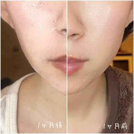 スカルプ電気ブラシ/アンファー(スカルプD)/美顔器・マッサージを使ったクチコミ(5枚目)