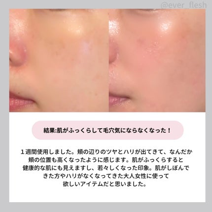 トリプルコラーゲンプレミアム美容液/VARI:HOPE/美容液を使ったクチコミ(7枚目)