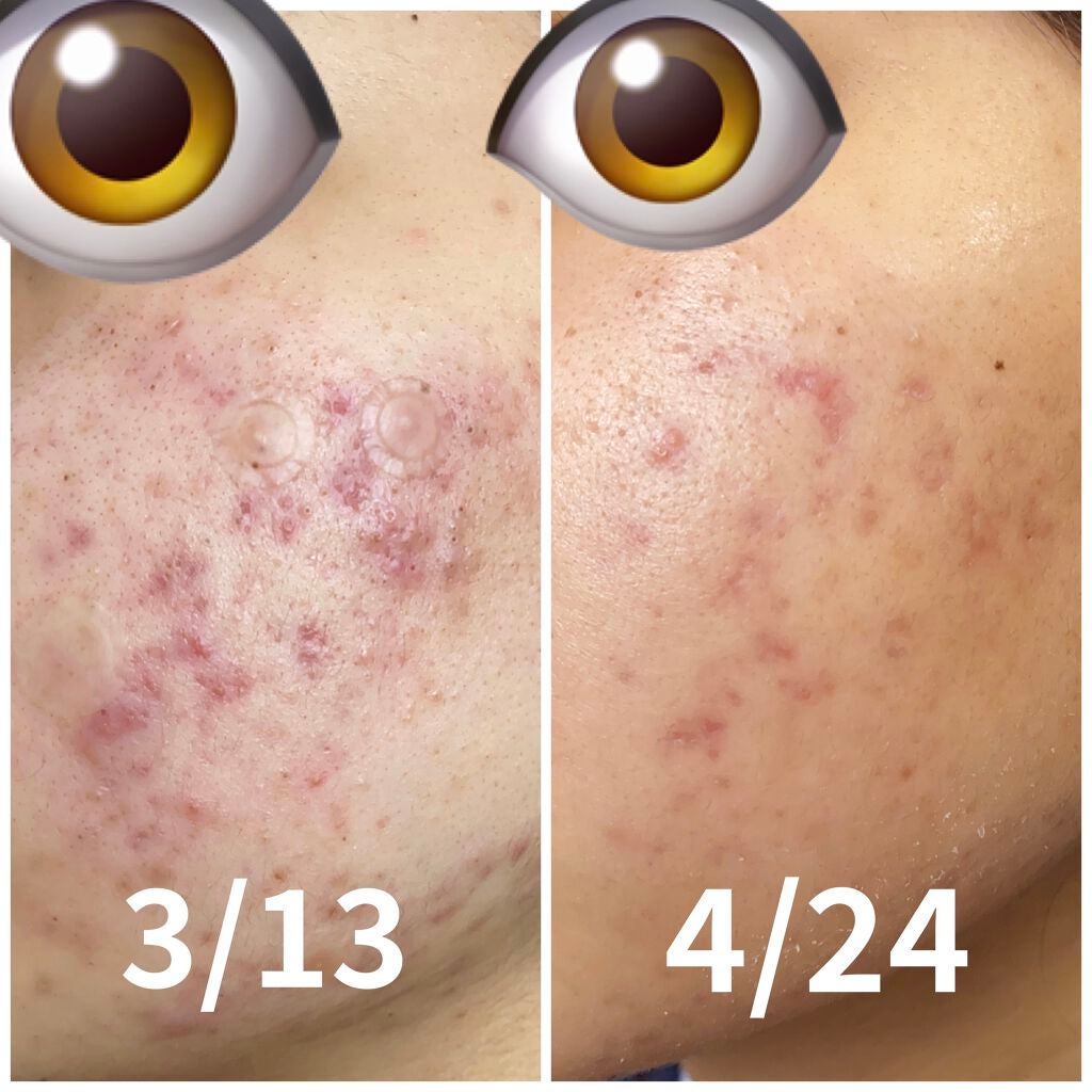 らんらん2号 on LIPS 「😭😭😭😭😭😭😭自分お疲れ様です!これからも続けてください3月末..」(1枚目)