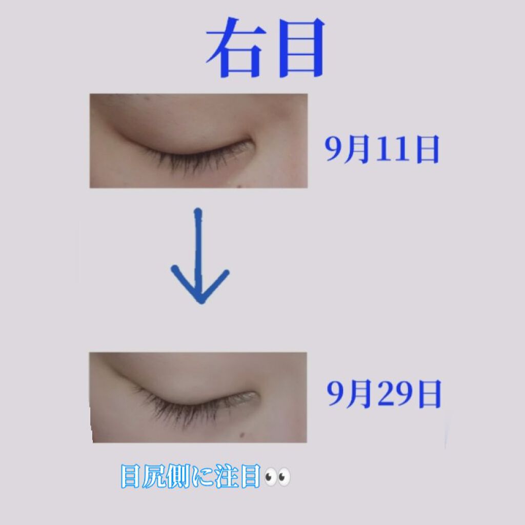 まつげ美容液EX/CEZANNE/まつげ美容液を使ったクチコミ（2枚目）