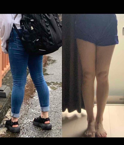 カロリミット/ファンケル/ボディサプリメントを使ったクチコミ(1枚目)