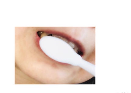 ORALUMINUS/mous./歯ブラシを使ったクチコミ(7枚目)