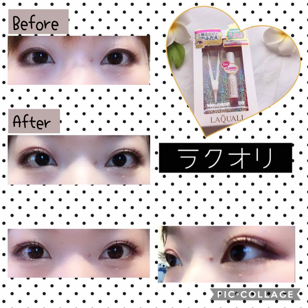 リキッドフィルム/ラクオリ/二重まぶた用アイテムを使ったクチコミ(2枚目)