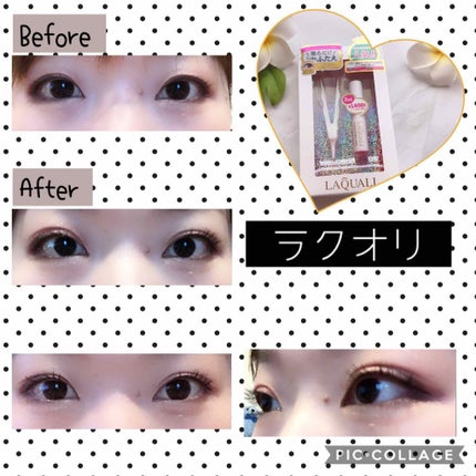 リキッドフィルム/ラクオリ/二重まぶた用アイテムを使ったクチコミ(2枚目)
