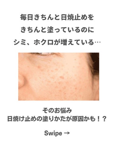 美肌カウンセラー💆綺麗のお助け相談所 on LIPS 「肌を綺麗にする専門家💆美肌カウンセラーおすすめ＼これでシミ改善..」（2枚目）