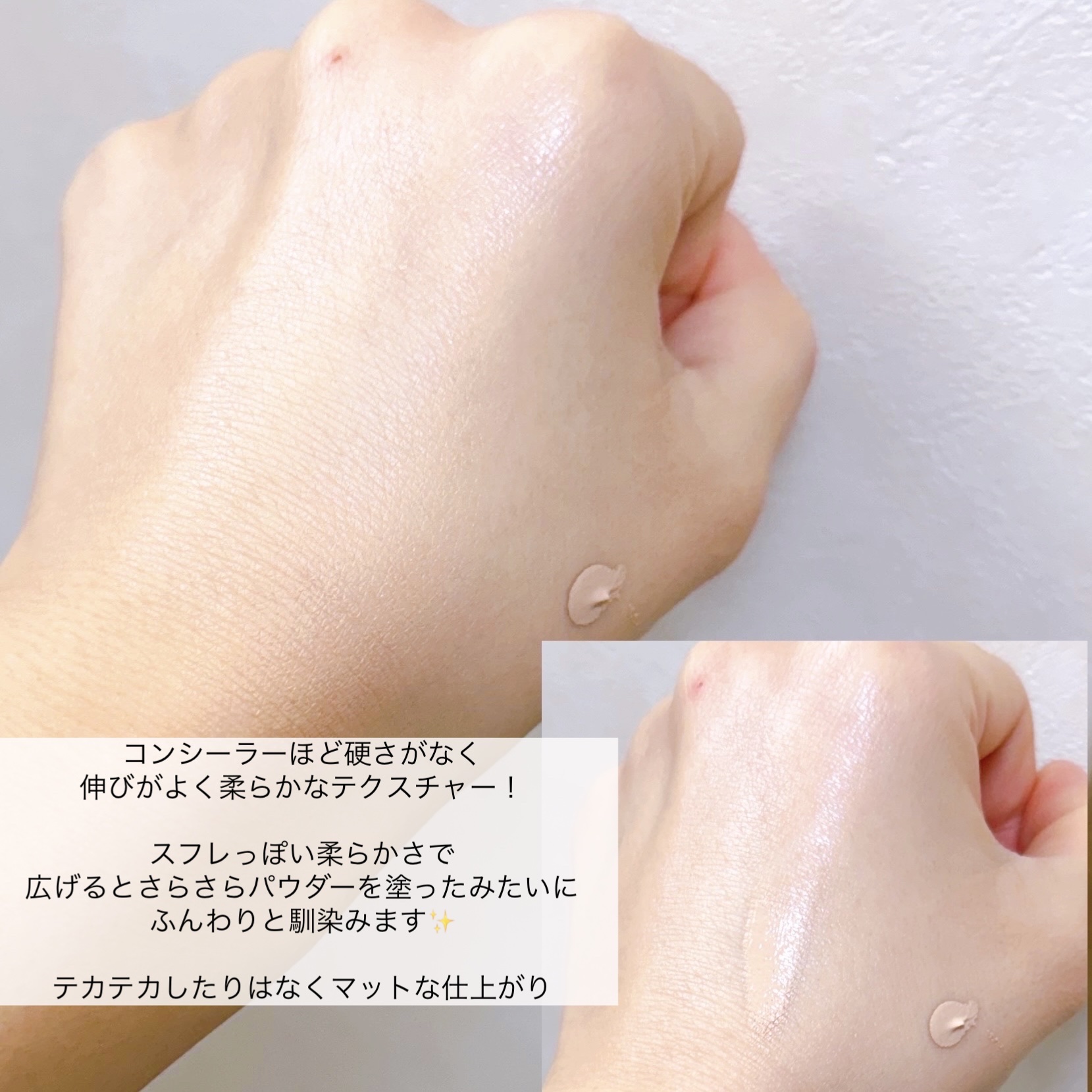 薬用スポットシーラークリーム/スキンヒーロー/クリームコンシーラーを使ったクチコミ（3枚目）