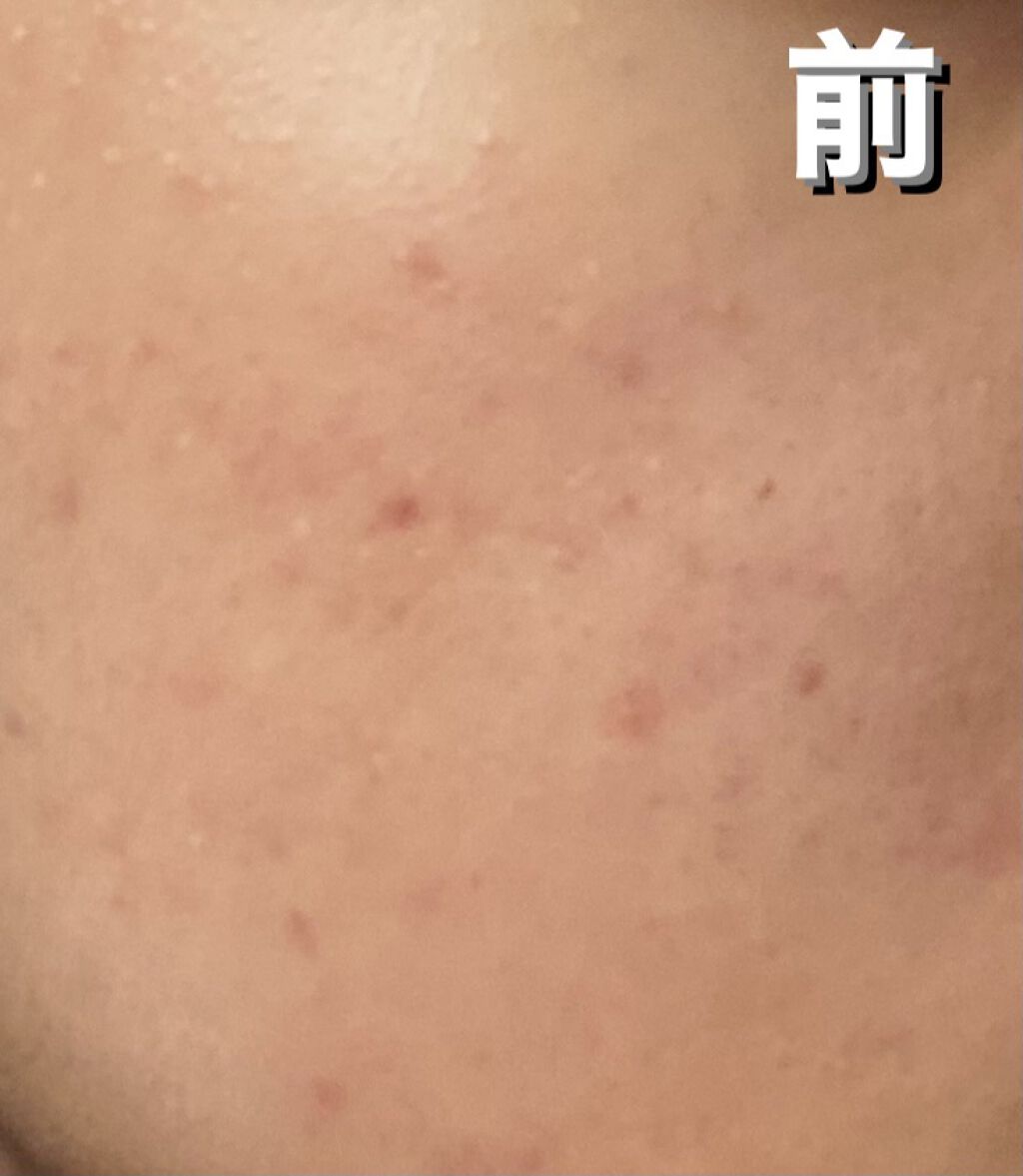 M クッション ファンデーション(モイスチャー)/MISSHA/クッションファンデーションを使ったクチコミ（2枚目）