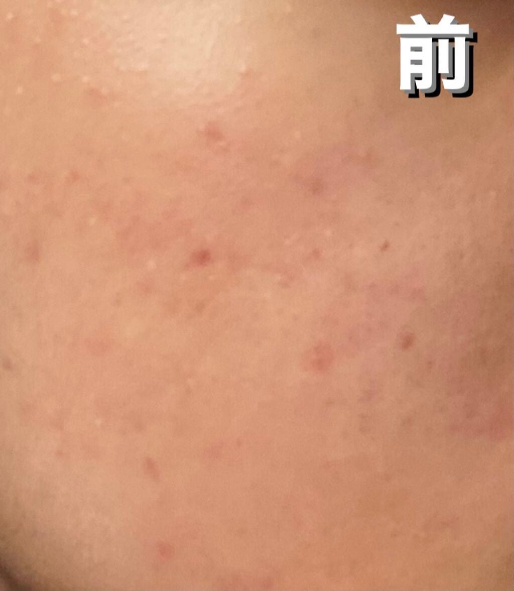 M クッション ファンデーション(モイスチャー)/MISSHA/クッションファンデーションを使ったクチコミ(2枚目)