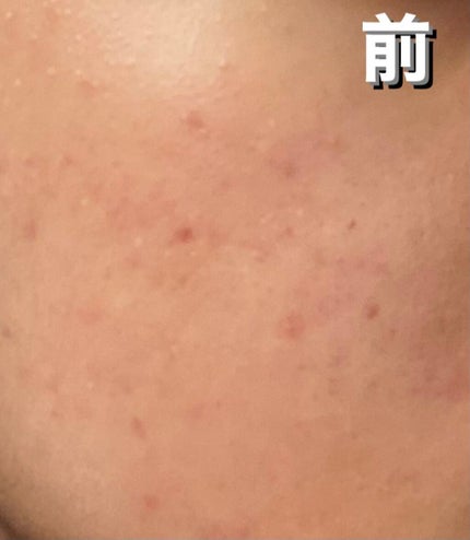 M クッション ファンデーション(モイスチャー)/MISSHA/クッションファンデーションを使ったクチコミ(2枚目)