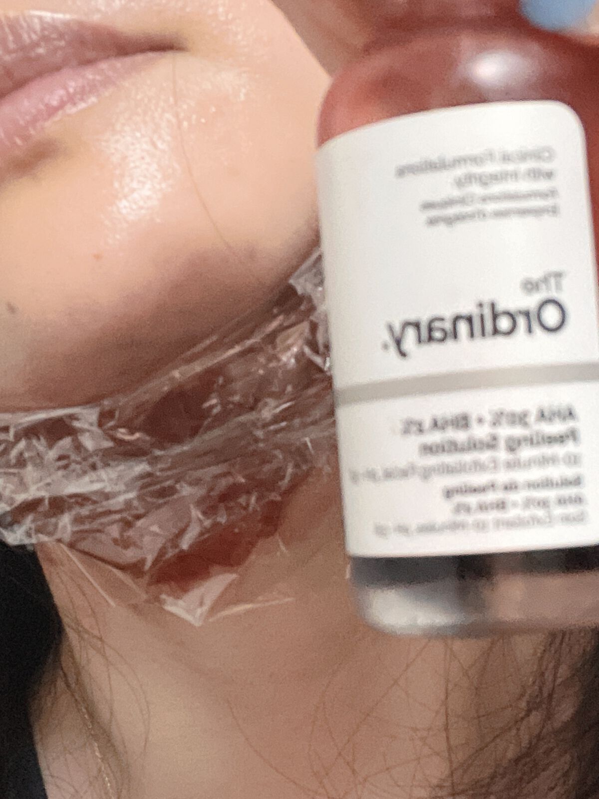 AHA 30% + BHA 2% Peeling Solution/The Ordinary/ピーリングを使ったクチコミ(3枚目)