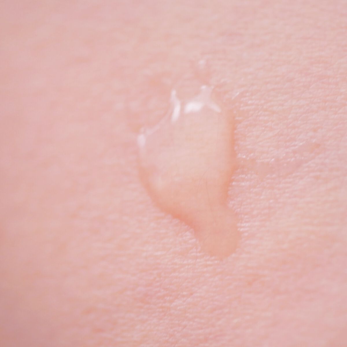 REVERSAL DROP/fonskin/美容液を使ったクチコミ(1枚目)