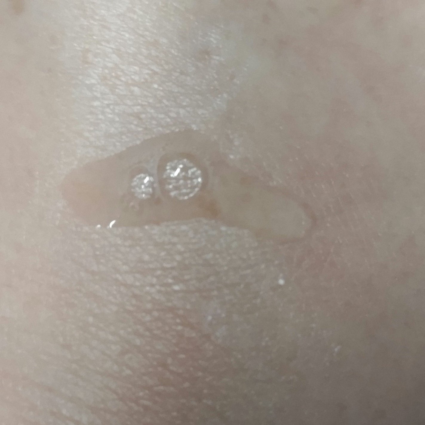 エファクラ ピールケア セラム/ラ ロッシュ ポゼ/美容液を使ったクチコミ(2枚目)