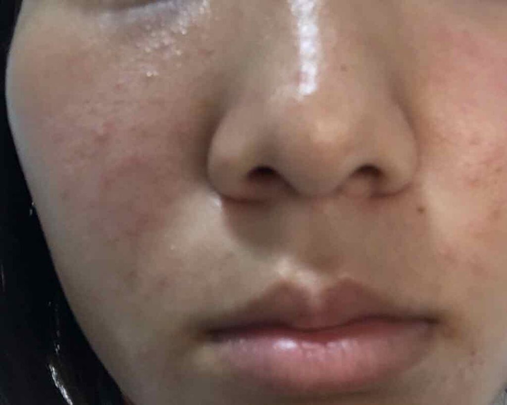 ハトムギ化粧水(ナチュリエ スキンコンディショナー R )/ナチュリエ/化粧水を使ったクチコミ（3枚目）