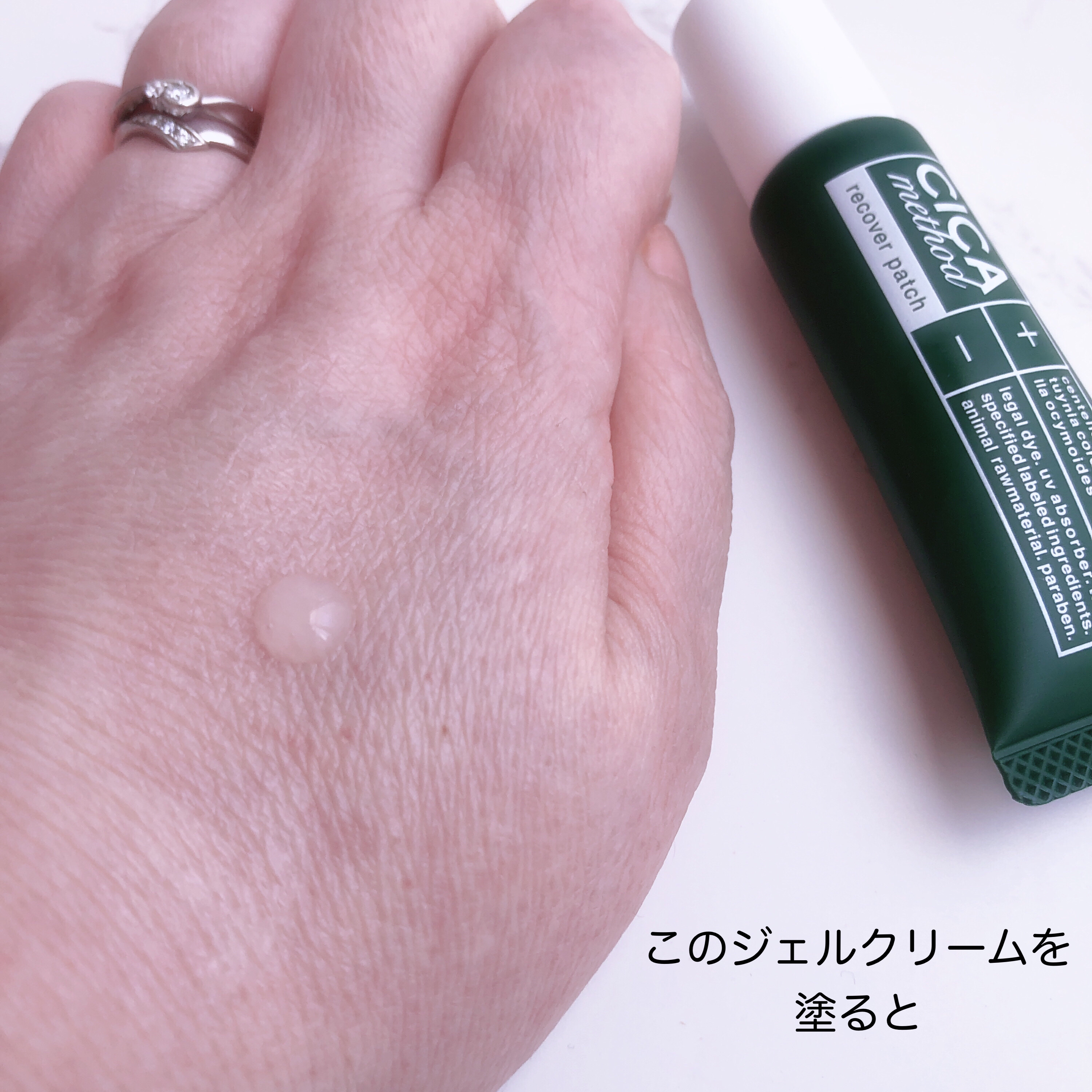 CICA method RECOVER PATCH/コジット/その他スキンケアを使ったクチコミ（2枚目）