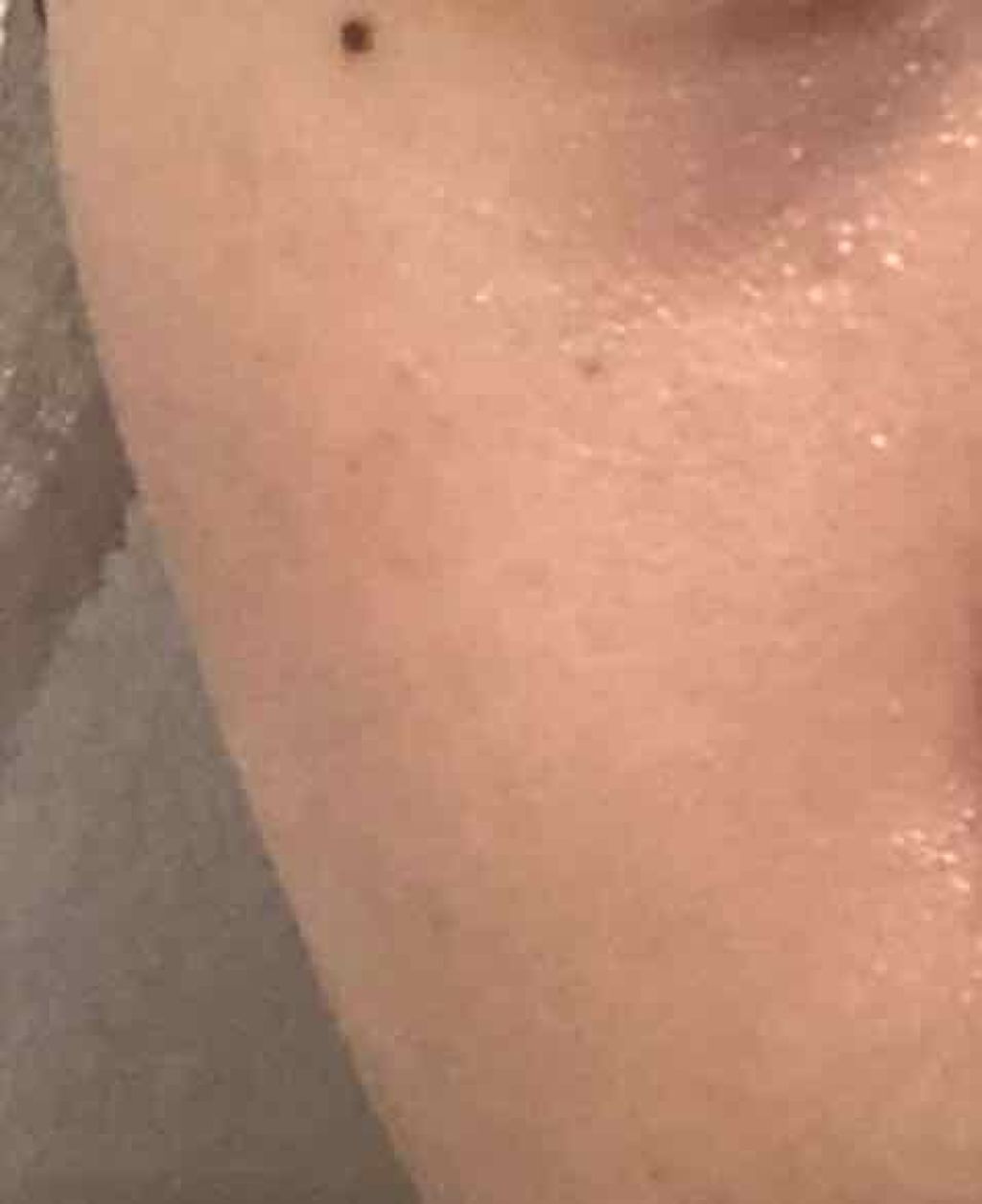 メラトックス スキン クリニック マスク/LEADERS/シートマスク・パックを使ったクチコミ（3枚目）