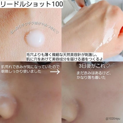 CICA クリーム/VT/フェイスクリームを使ったクチコミ(4枚目)