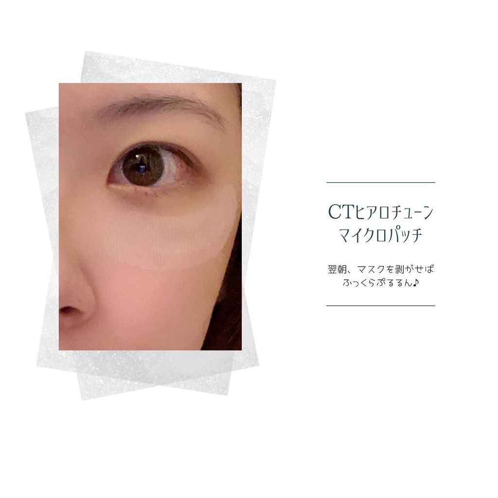 クリアターン ヒアロチューン マイクロパッチ 1500/クリアターン/シートマスク・パックを使ったクチコミ(3枚目)