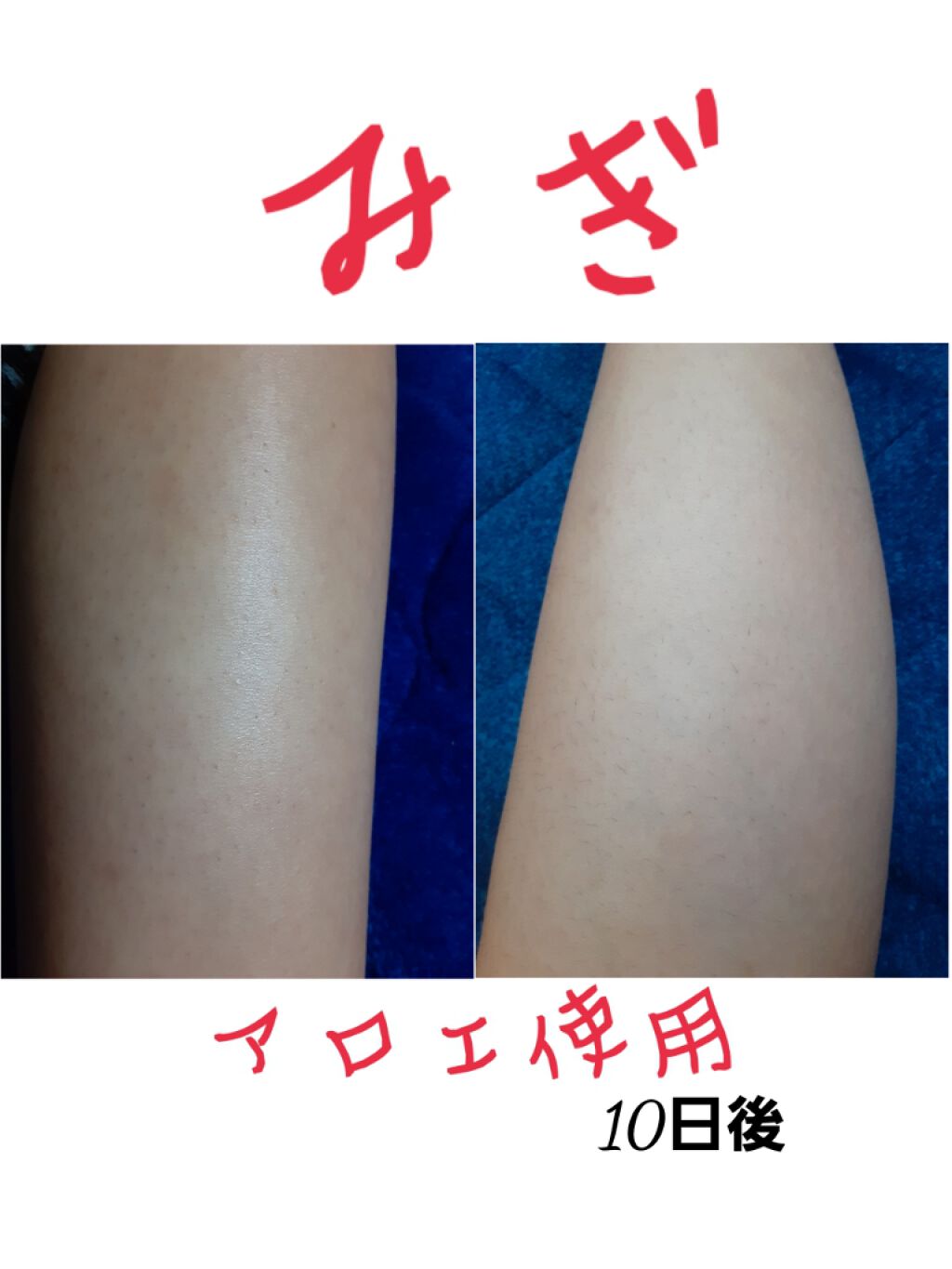 マイルド&モイスチャーアロエジェル/ネイチャーリパブリック/ボディローションを使ったクチコミ(3枚目)