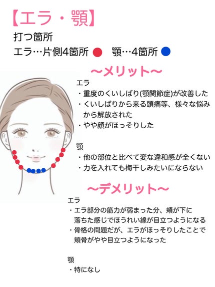 なー子⭐︎綺麗なママでいたい on LIPS 「私のボトックス体験談!※詳しくは画像をご覧ください♪私はこれま..」(4枚目)