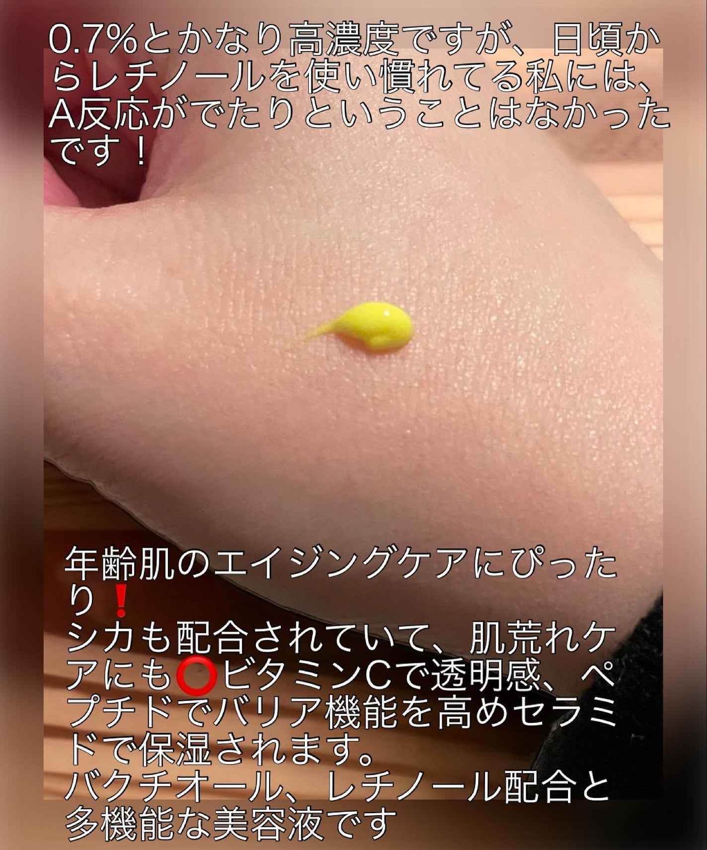 シカレチA エッセンス0.3/VT/美容液を使ったクチコミ(2枚目)