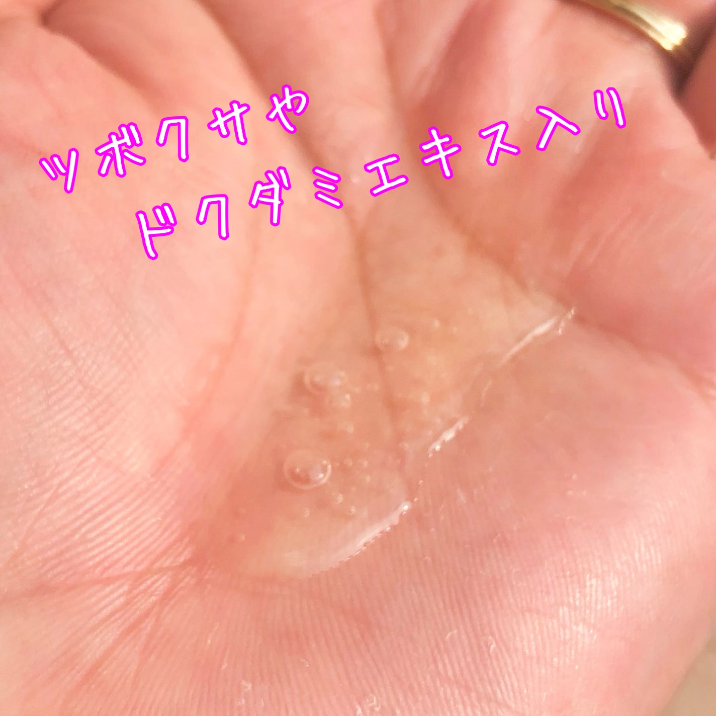 ナイトコラーゲンシャンプーミッドナイトフォレスト/treecell/市販シャンプーを使ったクチコミ(3枚目)