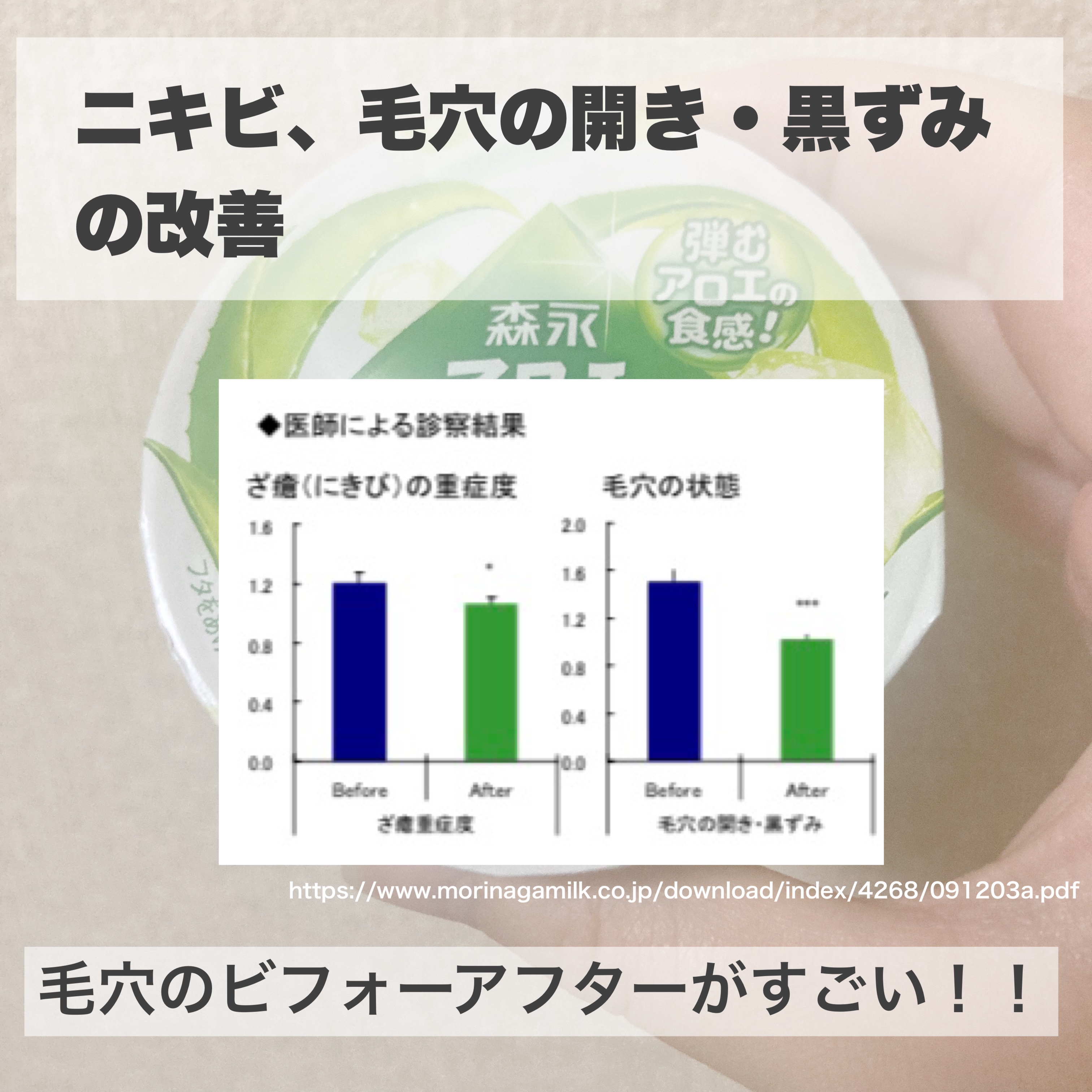 アロエヨーグルト/森永/ヨーグルトを使ったクチコミ（3枚目）