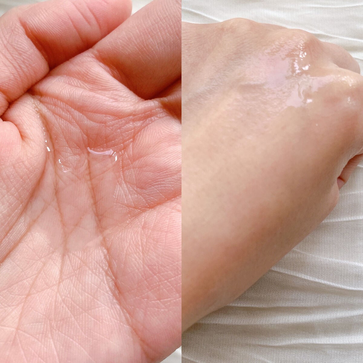 ピンクティーツリートナー/APLIN/化粧水を使ったクチコミ(4枚目)