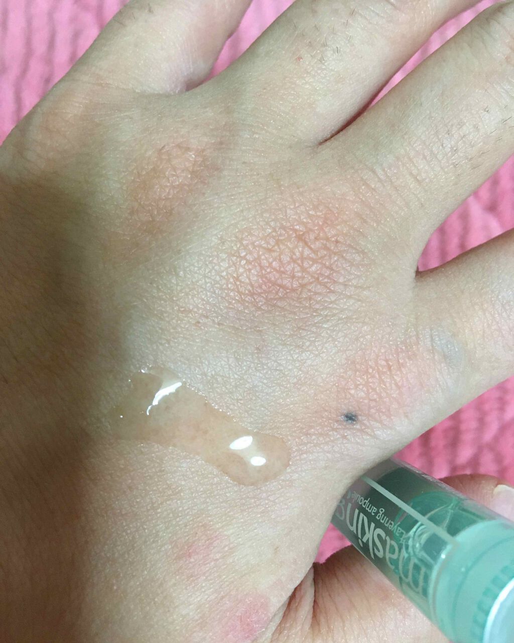 マスキング レイアリング アンプル /MEDIHEAL/美容液を使ったクチコミ（3枚目）