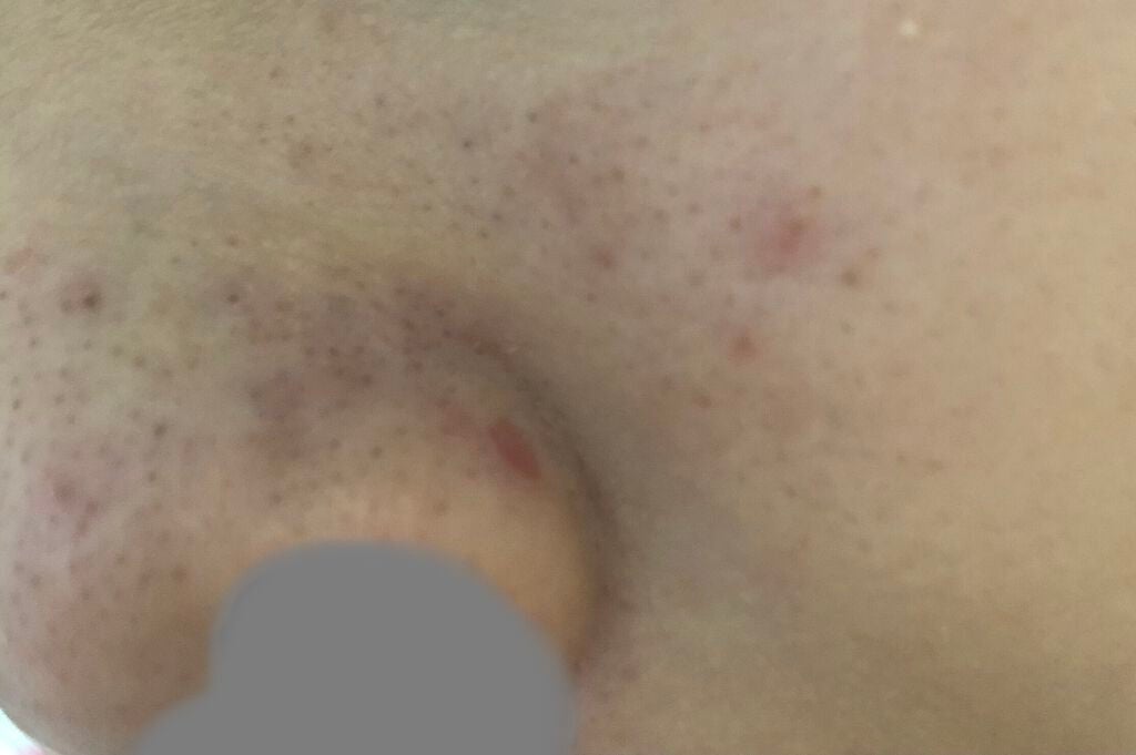 ドット・ウォッシー洗顔石鹸/ペリカン石鹸/洗顔石鹸を使ったクチコミ(3枚目)