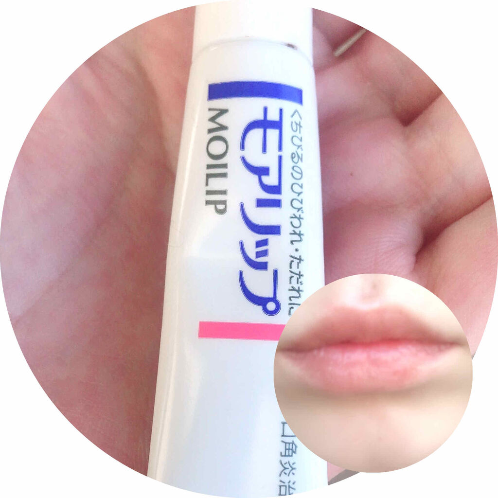 モアリップ N (医薬品)/資生堂薬品/その他を使ったクチコミ（1枚目）
