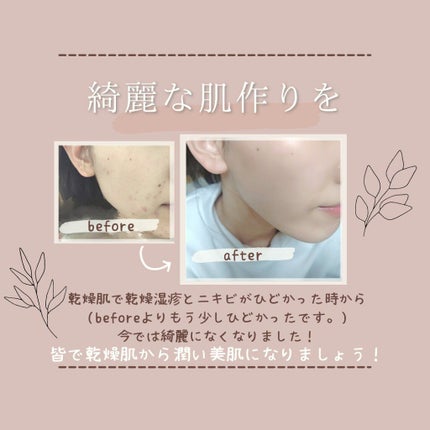 ガラクナイアシン2.0エッセンス/manyo/美容液を使ったクチコミ(4枚目)