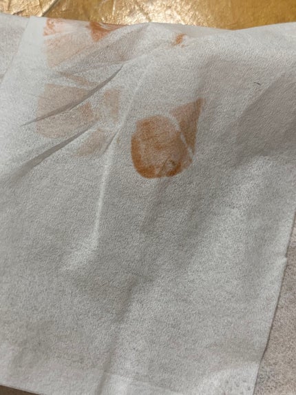 フルーティーグラムティント/Laka/リップティントを使ったクチコミ(6枚目)