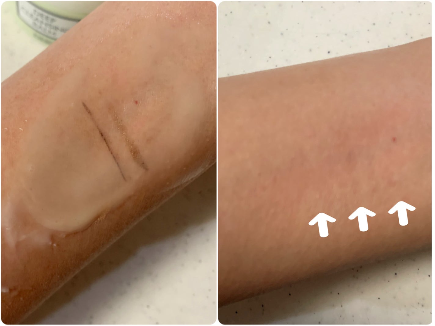 DHC ディープ クレンジング バーム/DHC/クレンジングバームを使ったクチコミ(4枚目)