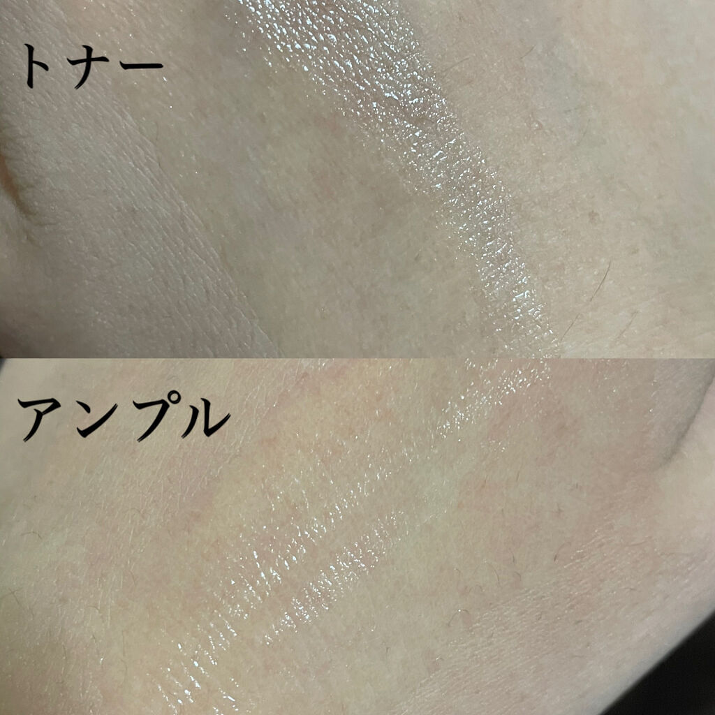 ドクダミ 77 スージングトナー/Anua/化粧水を使ったクチコミ（3枚目）