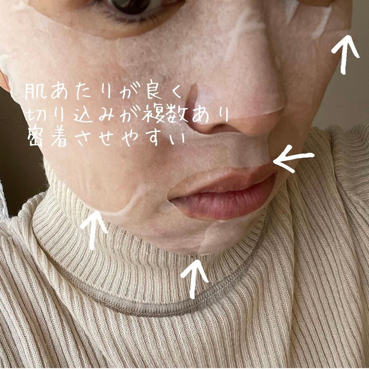 スキントラブルケア マスク/アルージェ/シートマスク・パックを使ったクチコミ(3枚目)