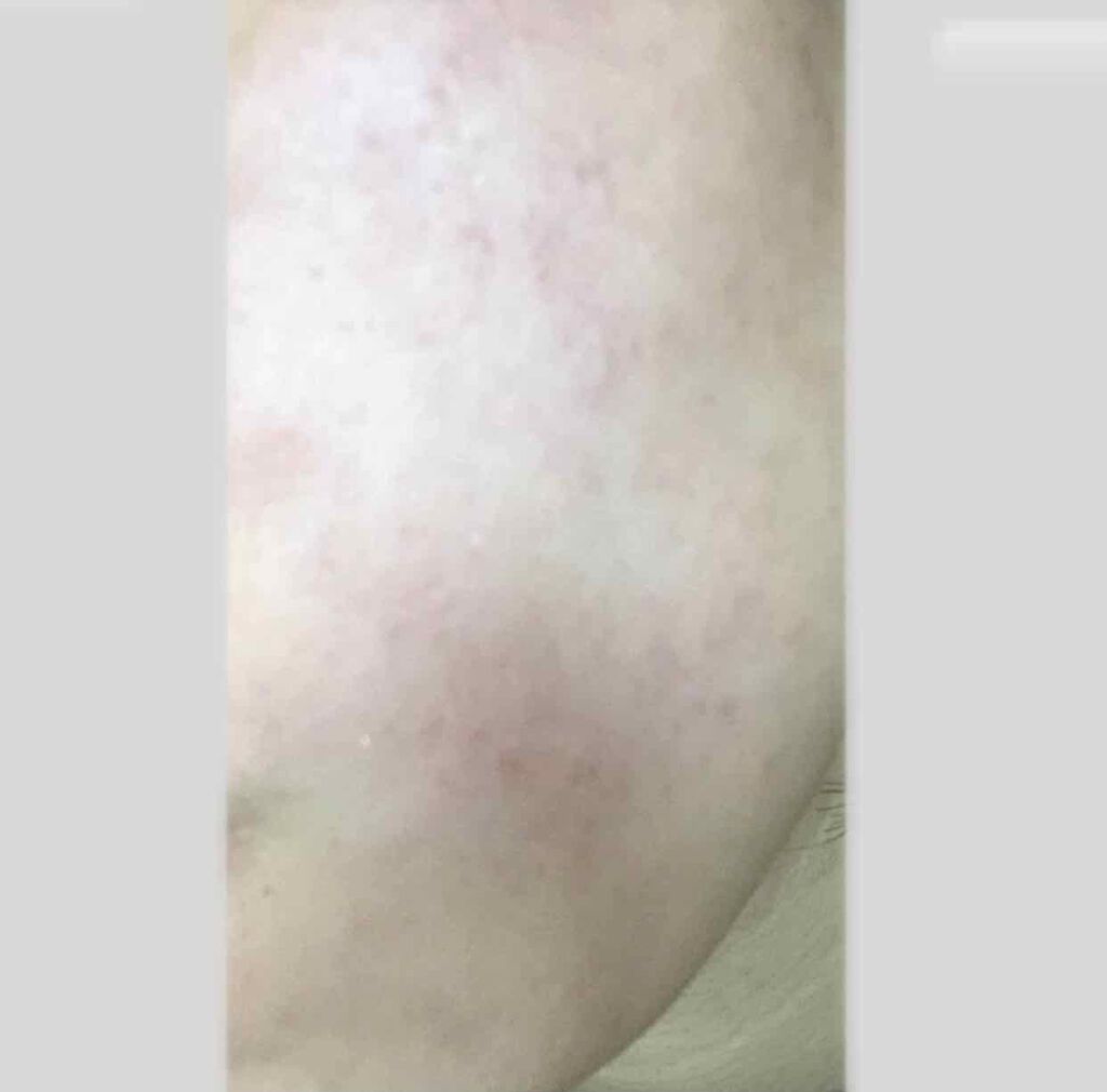 パラソーラ イルミスキン フェイスパウダー UV/ナリスアップ/プレストパウダーを使ったクチコミ（2枚目）