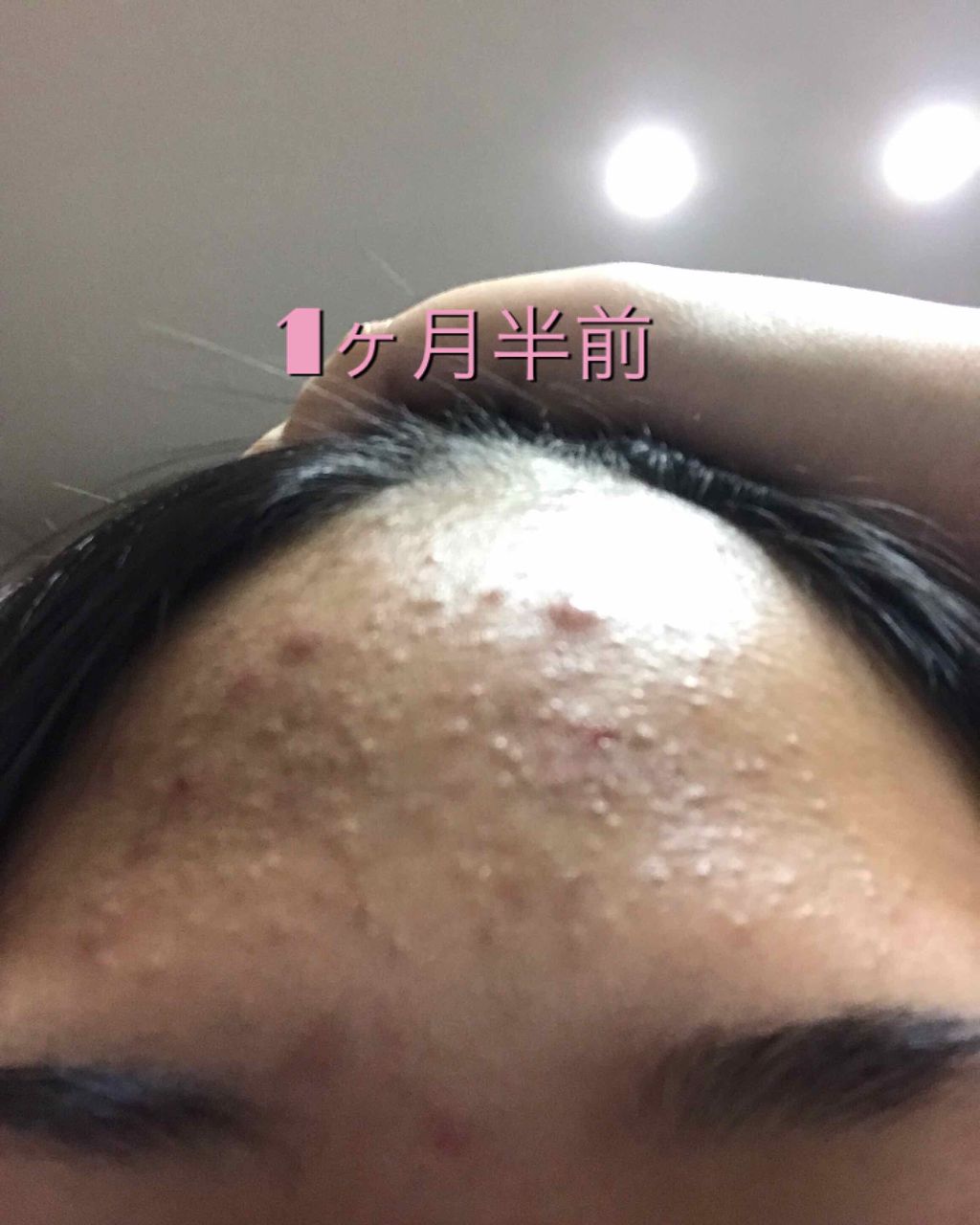 薬用パウダー化粧水/メンソレータム アクネス/化粧水を使ったクチコミ(2枚目)