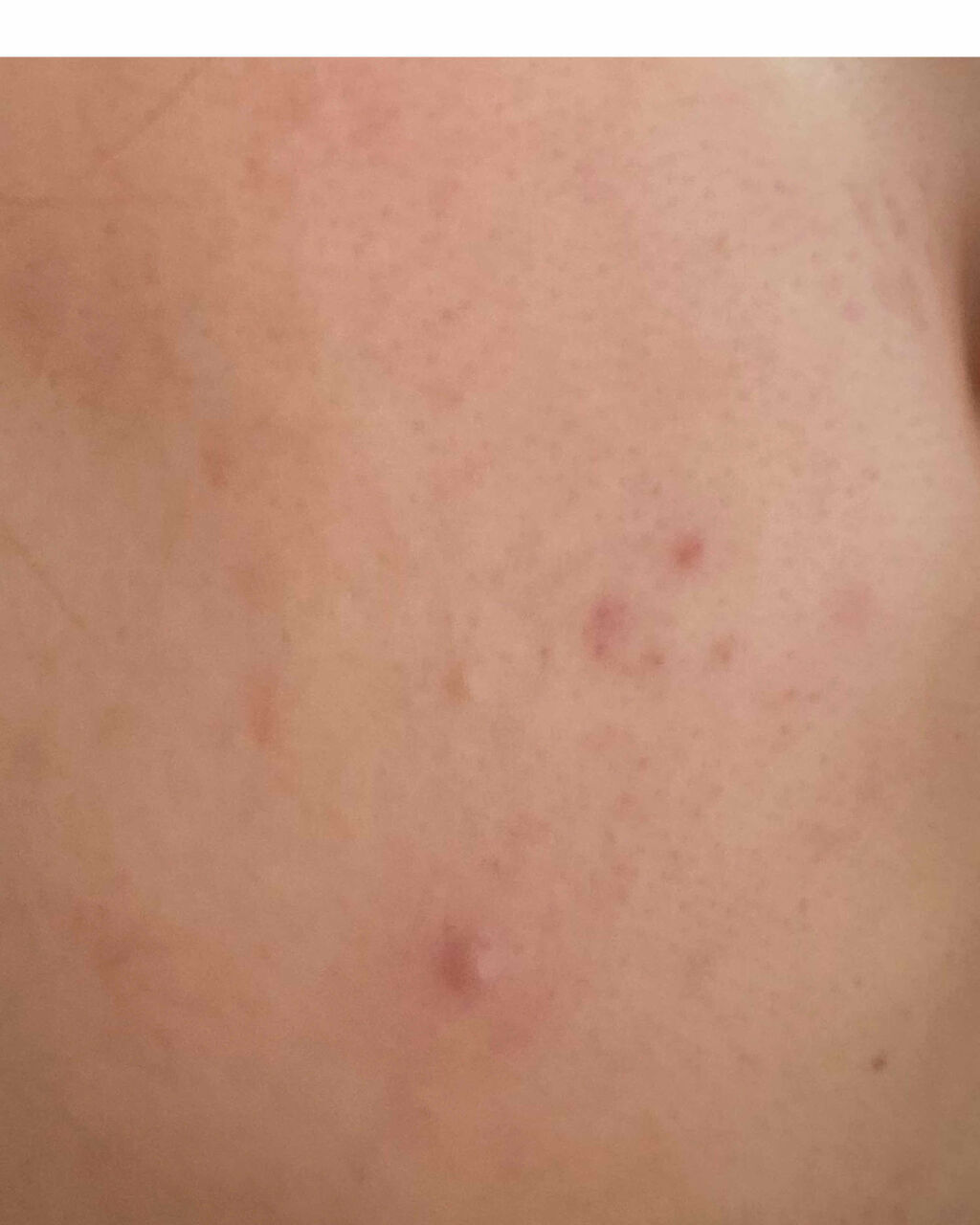 ハトムギ化粧水(ナチュリエ スキンコンディショナー R )/ナチュリエ/化粧水を使ったクチコミ（2枚目）