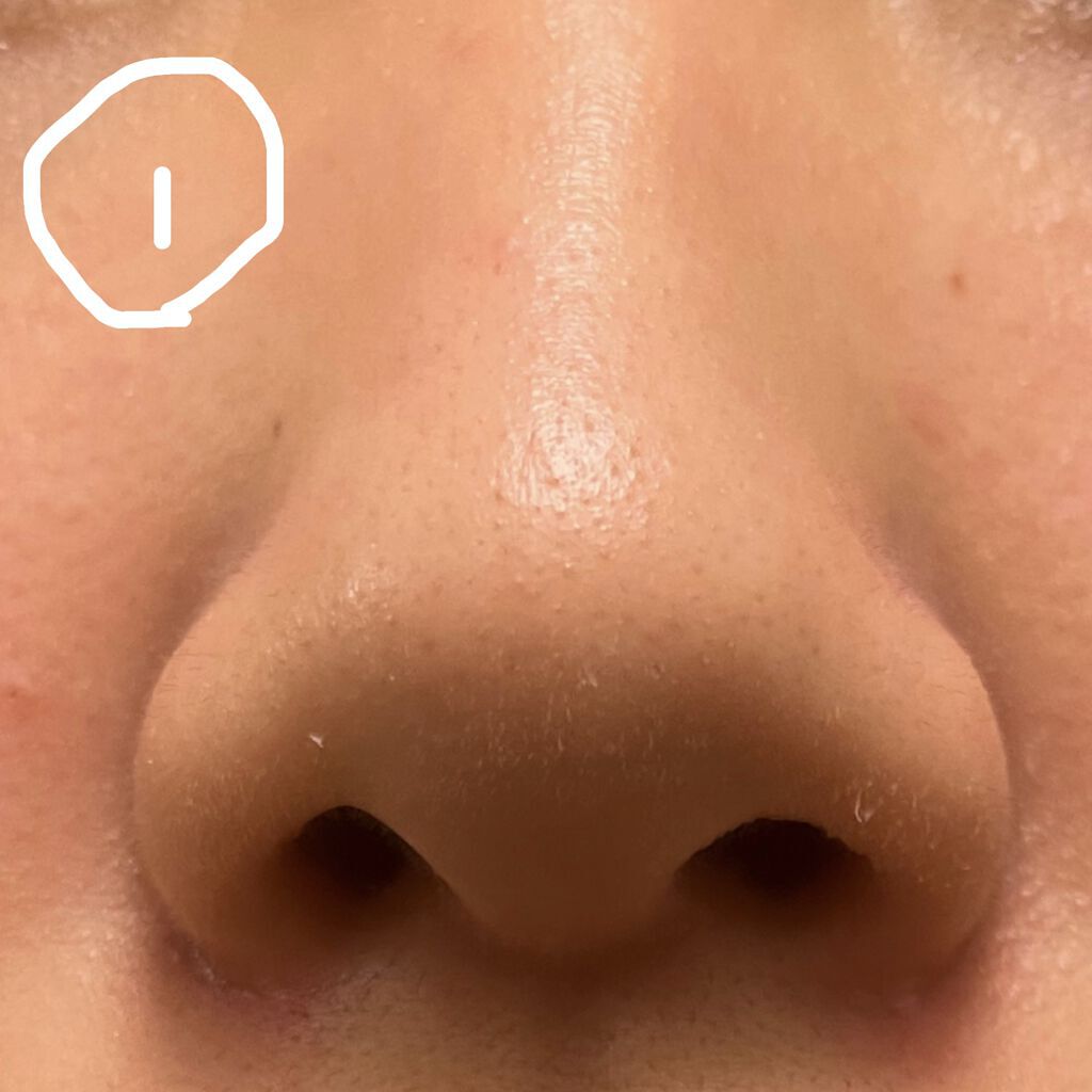 DETクリア ブライト＆ピール ピーリングジェリー <ミックスベリーの香り>/Detclear/ピーリングを使ったクチコミ（2枚目）