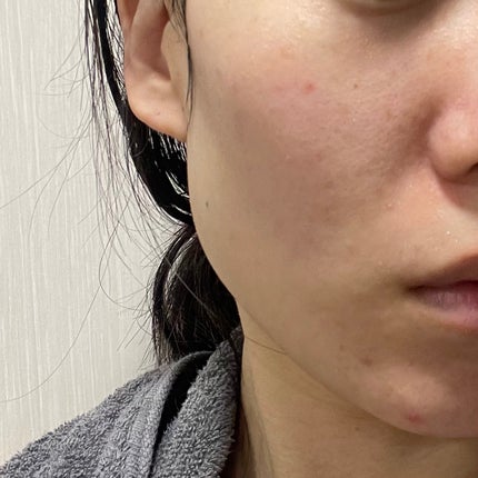 バイオ コンディショニング エッセンス/IOPE/ブースター・導入液を使ったクチコミ(3枚目)