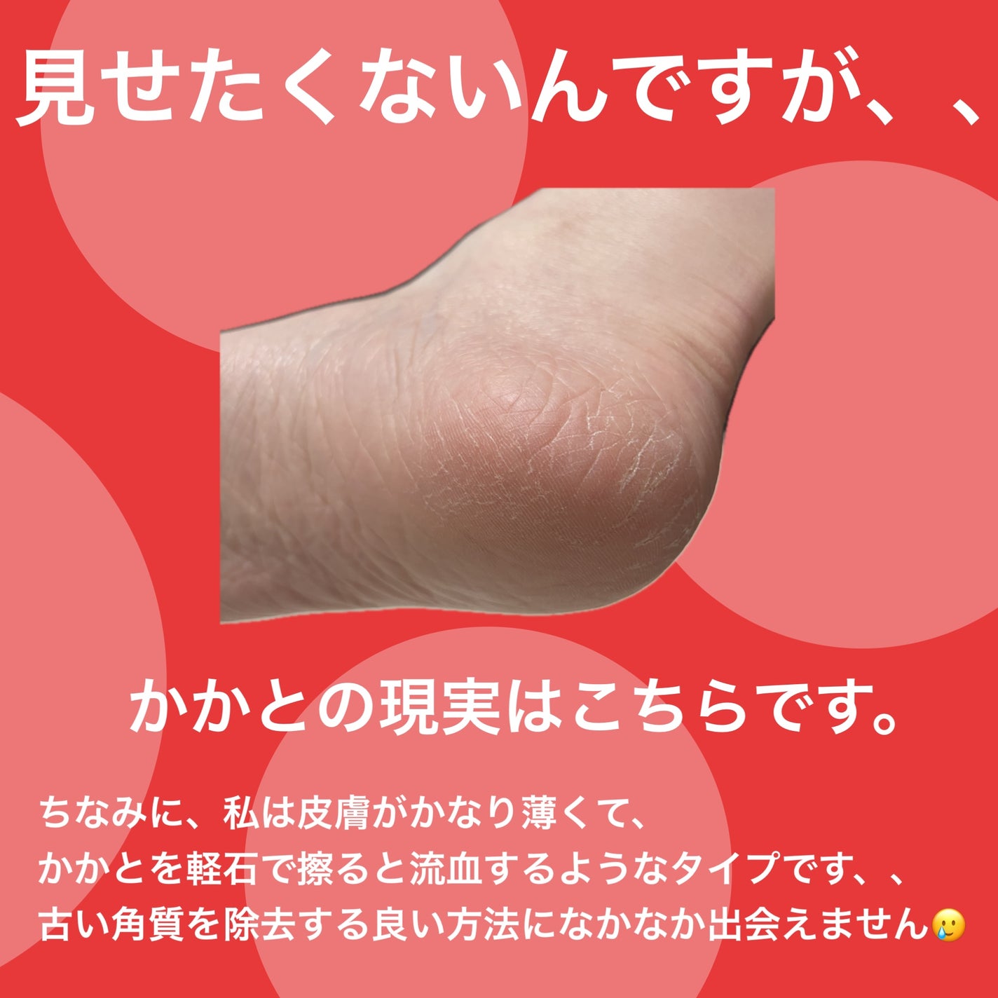 イージーパックDP60分タイプ/ベビーフット/レッグ・フットケアを使ったクチコミ(2枚目)