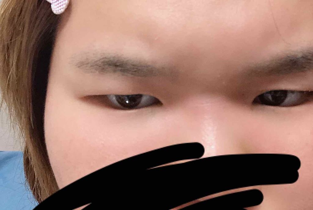 アイトーク/アイトーク/二重まぶた用アイテムを使ったクチコミ(2枚目)