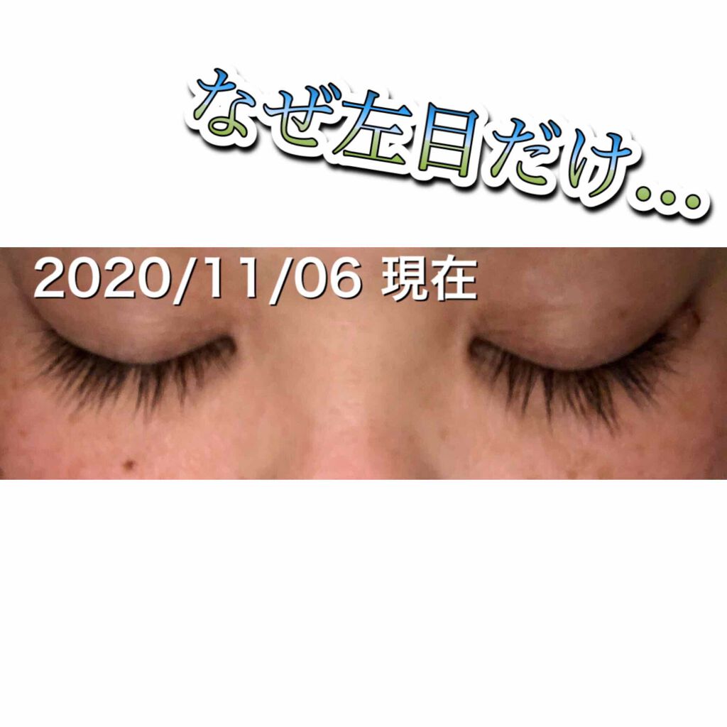 スカルプD ボーテ ピュアフリーアイラッシュセラム　プレミアム/アンファー(スカルプD)/まつげ美容液を使ったクチコミ（2枚目）