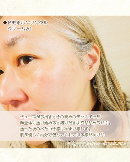 クリーム20/ドモホルンリンクル/フェイスクリームを使ったクチコミ(7枚目)
