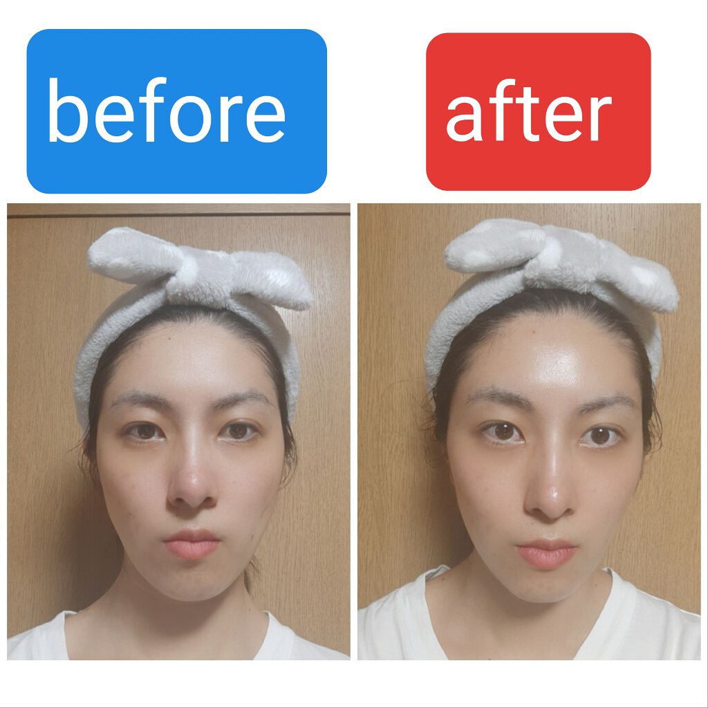 キャビテーションです。マッサージジェルをアロエジェルで代用して