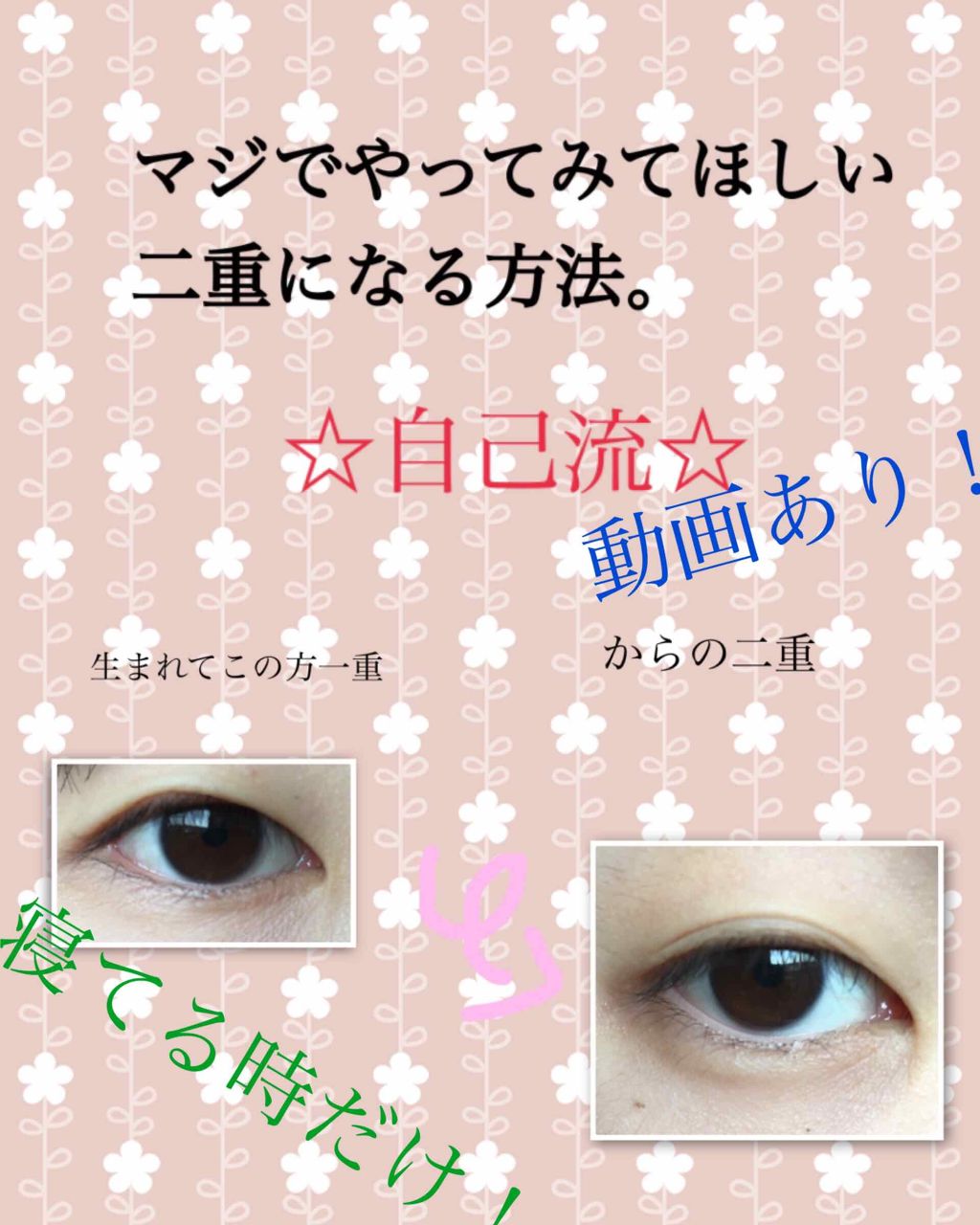 のびーるアイテープ(絆創膏タイプ、レギュラー)/DAISO/二重まぶた用アイテムを使ったクチコミ(1枚目)