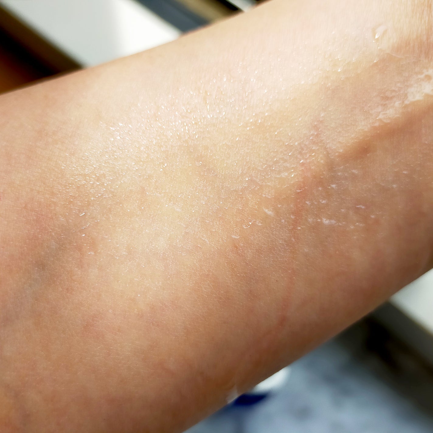 タカミスキンピール/タカミ/ブースター・導入液を使ったクチコミ(4枚目)